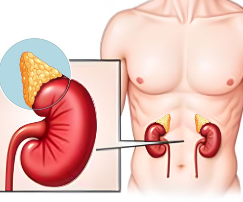 Insuficiencia suprarrenal en adultos: una revisión